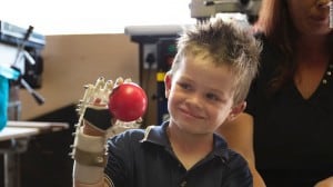 Liam and his Robohand