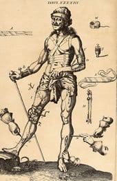 Johannes Scultetus (1595-1645). Armamentarium chirurgicum. Ulm: Typis& impenis Balthasari Kühnen, 1655.