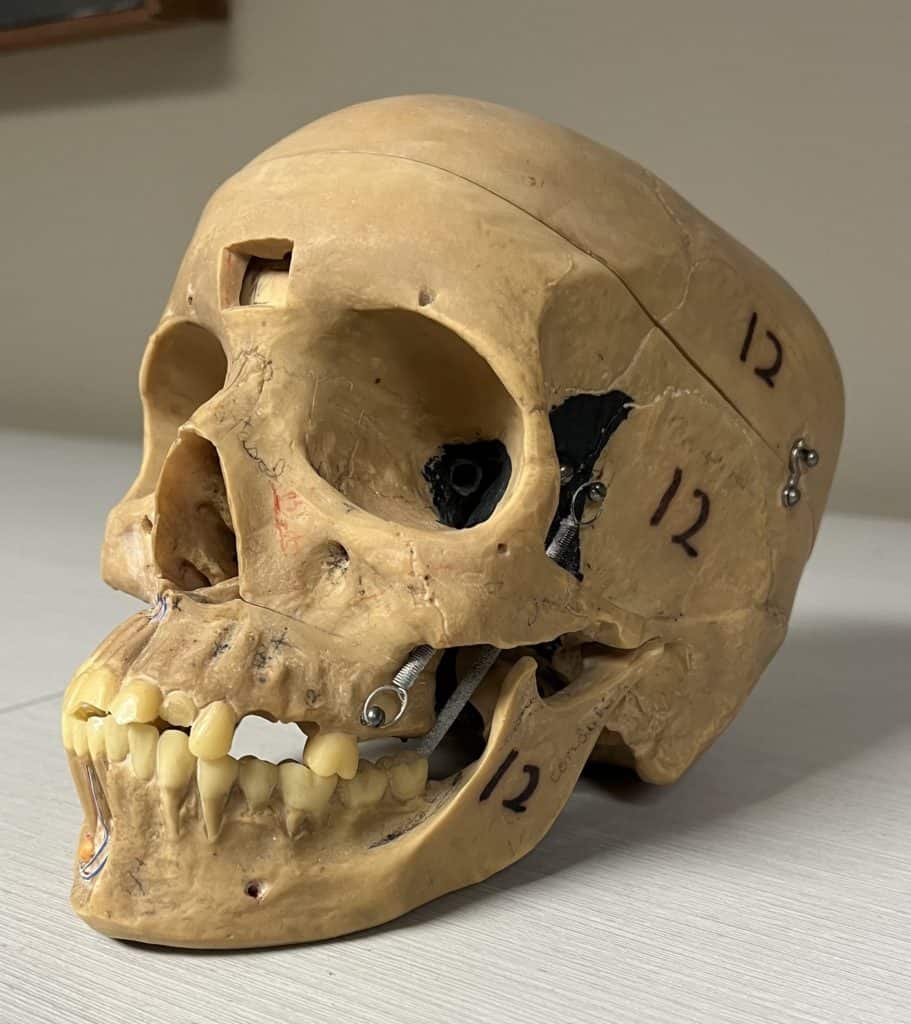 A model human skull with one missing tooth and the number 12 written on its' side