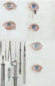 images of tools and eye disease