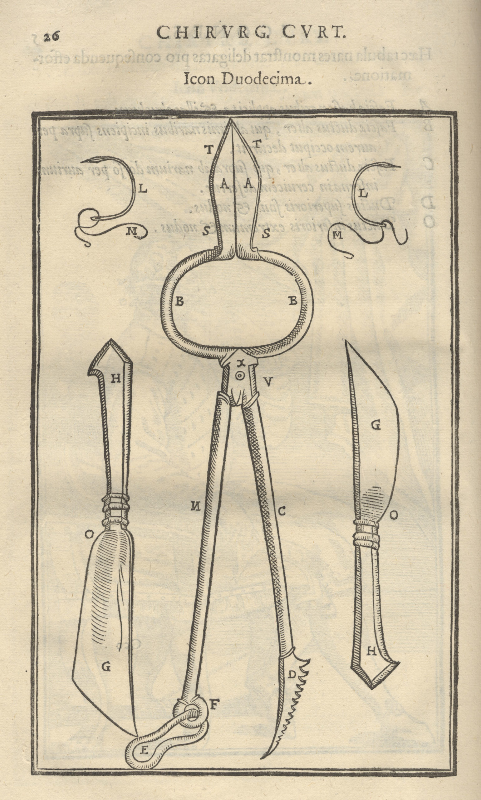 woodcut of 15th century Italian surgical tools