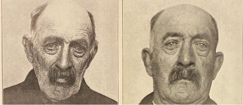 before and after photographs of a man